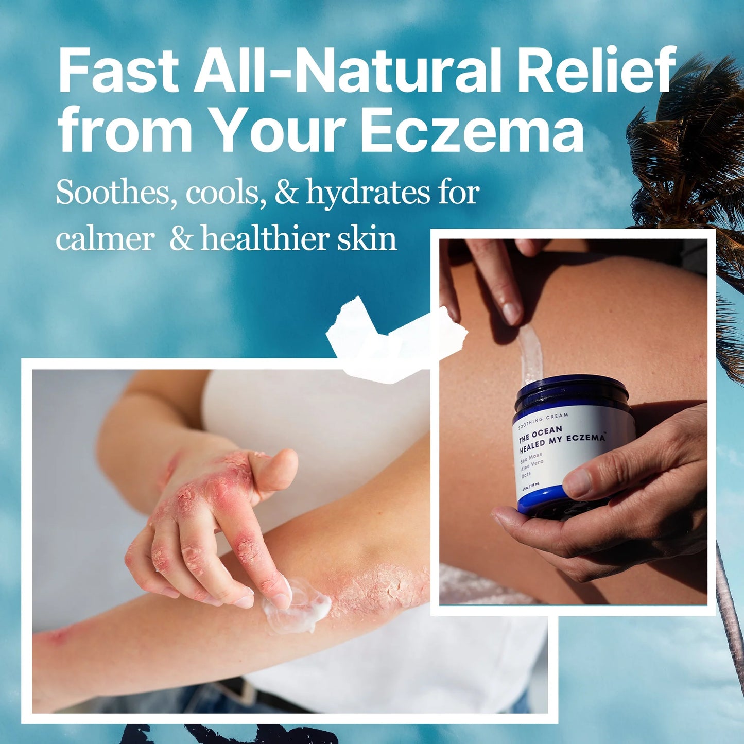CoraLane™ EczEase - Soothing Cream