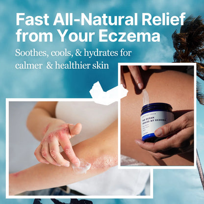 CoraLane™ EczEase - Soothing Cream